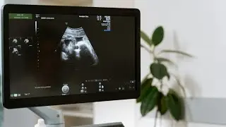 Antenatal card filling|EDD calculation from LMP|Gyne-Obs M.B.B.S