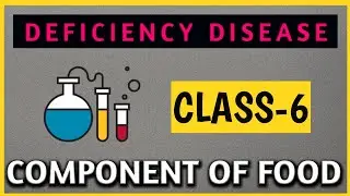 Class6 Component of food (Deficiency diseases) #class6science by toppers coaching class