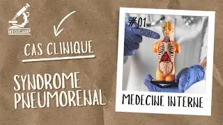 Cas clinique en médecine interne (épisode 01): Syndrome pneumorénal