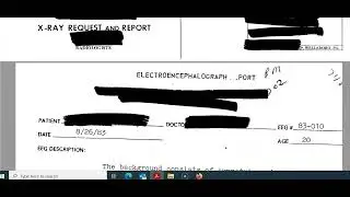 INPT38 Case