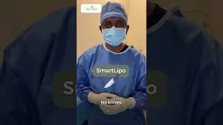 What is Smart Lipo by Dr. Erella
