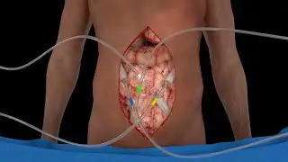 3D Product Animation medical Base