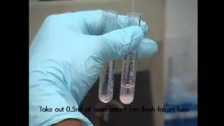 Krishna IVF Clinic | Sperm Cryo Preservation