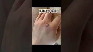 SKIN CARE ,TAG REMOVER #shots #beautiful #viral #trending #beauty #trendingshorts #facebook #FACE