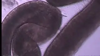 Stinging Cells And No Brains As Well! What Are Cnidarians?