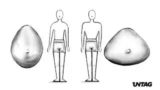 Oval and triangle MtF breast prosthetics from UNTAG