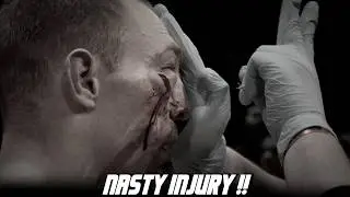 The Most RAW, BRUTAL Bare Knuckle Boxing of Top Dog 40 PART 2 | HIGHLIGHTS