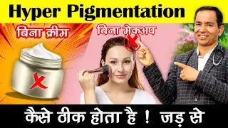 How to treat hyperpigmentation without cream or makeup. Naturally remove pigmentation from the root.