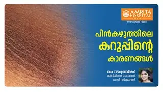 കഴുത്തിലെ കറുത്ത നിറം എന്തുകൊണ്ട്? | Amrita Hospital Kochi