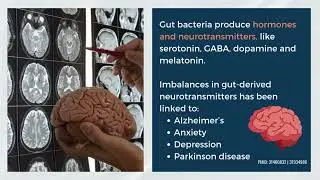 Why You Must Fix Your Gut! (The Secret to Whole-Body Health) 🌿🧠