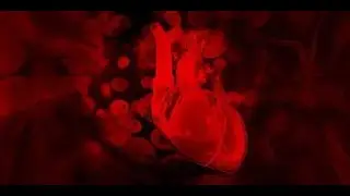 Atrioventricular Nodal Blocks , Classifications   1st , 2nd and 3rd degrees