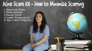 How to Minimize Acne Scarring