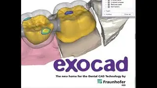 CURSO CAD-CAM / REGISTRO EN HOJA DE TRABAJO Y ESCANEO DE MODELOS EN MEDIT