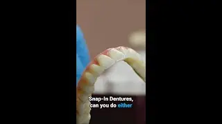 Can you have Snap-In Dentures on either the top or bottom jaw?