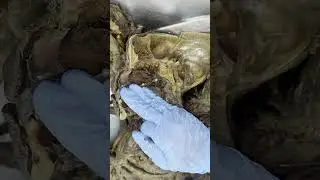 Irrig-Inerv Cav. Nasal y Nasofaringe