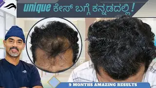 Hair Transplant In Mangalore | Best Clinic Surgeon & Center Of Hair Transplant In Mangalore