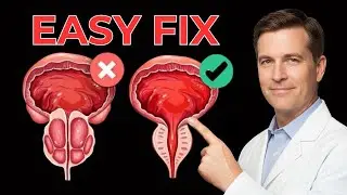 TOP 10 FOODS to Shrink an Enlarged Prostate (Especially Over Age 50) - Prime Men&rsquo;s Health