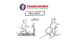 Etalagebenen (claudicatio intermittens) informatievideo De Rooy Fysiotherapie.