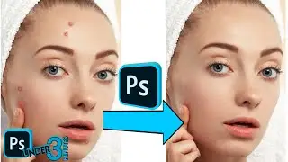 How to remove and Retouch pimples, spots and acne in  Adobe Photoshop