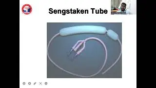 Department of Surgery UPPER GI BLEED