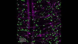 Sea Anemone Neurons and Stinging Cells Showing Their Dynamic Processes | 2022 Nikon Small World