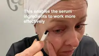 Eye Cell advanced home care kit