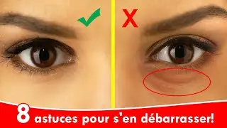 8 astuces naturelles pour venir &agrave; bout des cernes et des poches