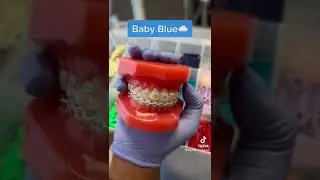 Braces colors you should be getting!🤩✨ #jeffersondental #braces #bracescolors #bestbraces