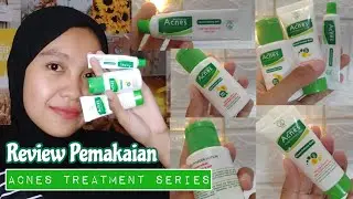 Review Acnes Treatment Series || Skincare kulit berminyak & berjerawat