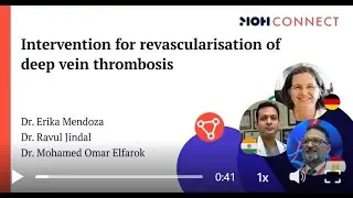 MOH Deep Venous Intervention & Venous Stenting | Chronic Venous Disease Webinar