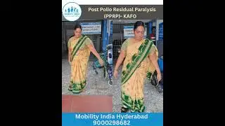 KAFO Gait Training for PPRP: Day 1 vs After Training | Remarkable Gait Transformation