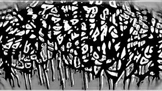 Severe prolapse caused by botched Colorectal surgery with bowel resection. - 8 untitled tracks.