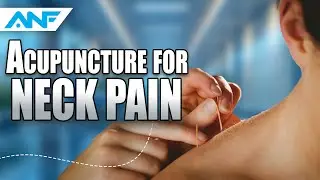 Acupuncture for Neck Pain