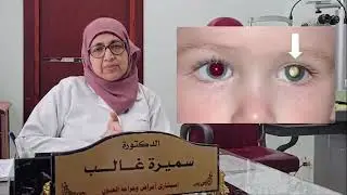 متى يجب فحص عيون الأطفال وماهي مضاعفات عدم الفحص المبكر؟  د. سميرة غالب