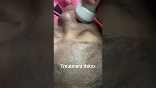 treatment detox#salon savira#zaynfamily03#ditdim family#sab hair and beauty #viralshorts
