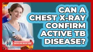 Can a Chest X-ray Confirm Active TB Disease?