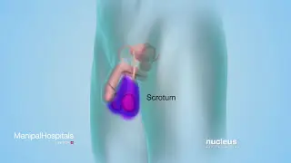 Male Infertility | Semen Analysis and Donation | Semen Analysis Test - Manipal Hospitals