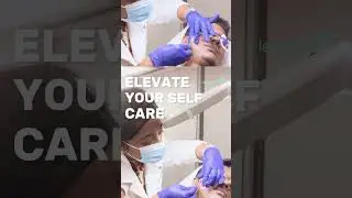Subcision & PRP for Acne Scars | Permanent Acne Scar Treatment at LaserTreat