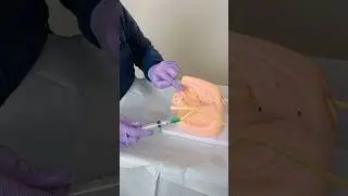 Понимание того, как работает катетер Фолея🏥 #студентмедучилища #анатомияФолея