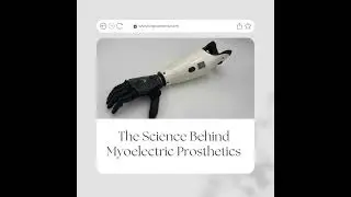 Myoelectric prosthetics are revolutionizing the field!