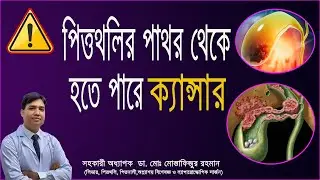 পিত্তথলির পাথর (Gallbladder Stone) থেকে হতে পারে ভয়ঙ্কর ক্যান্সার!