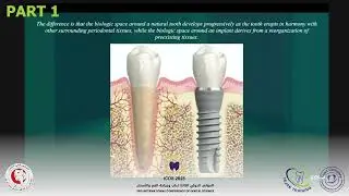 Soft Tissue Management Around Implants | Prof. Elias El Haddad Lecture &ndash; Tripoli University (Part 1)