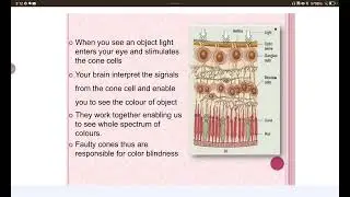 Color Blindness | Causes | Sign & Symptoms | Diagnosis | Management 