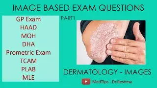 PART 1 - GP IMAGE BASED QUESTIONS|HAAD|MOH|PROMETRIC|TCAM|DHA|PLAB|USMLE|LICENCING EXAMS