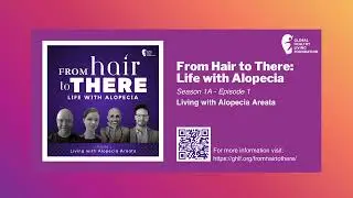 Living with Alopecia Areata