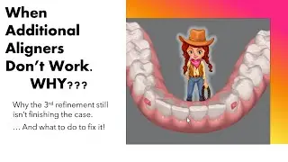 Invisalign ClinCheck - When Additional Aligners Don't Work.  WHY??  And How to Fix It!