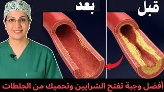 أفضل وجبة تفتح الشرايين وتحميك من الجلطات   كلام علمي بالأدلة