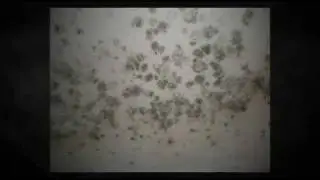 Jupiter Mold Damage Repair (561) 922-9917