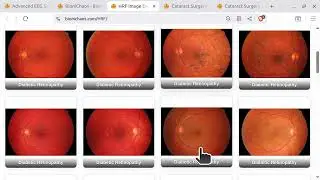 AI Agents Debug Cataract Surgery Sim: GPT-4o, Claude & O3-Mini