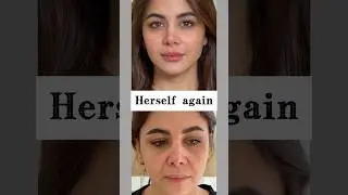 It&rsquo;s not about looking younger.It&rsquo;s about looking less heavy.More refreshed overall.